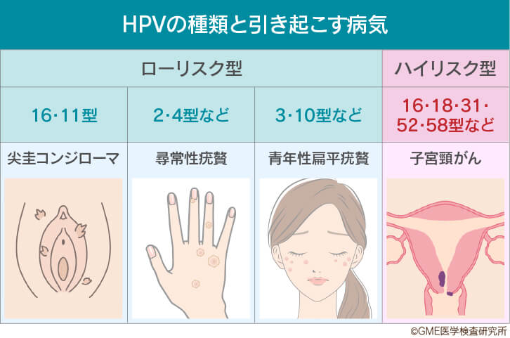HPVの種類と引き起こす病気。ローリスク型、16・11型は尖圭コンジローマ。2・4型などは尋常性疣贅。3・10型などは青年性扁平疣贅。ハイリスク型、16・18・31・52・58型などは子宮頸がん。