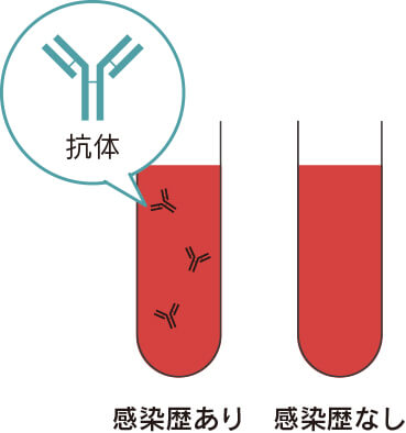 血液中の抗体の有無で感染歴を調べる