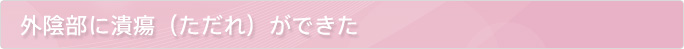 外陰部に潰瘍(ただれ)ができた