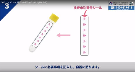 膣分泌物検査3