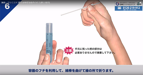 膣分泌物検査6