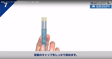 膣分泌物検査7