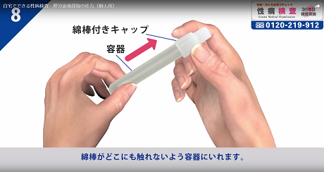 膣分泌物8