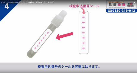 陰茎表皮擦過物検査4