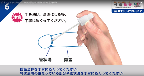 陰茎表皮擦過物検査6