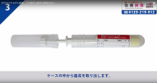 子宮頸がん検査3