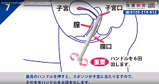 子宮頸がん検査7