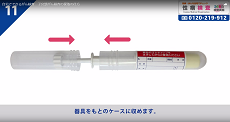 子宮頸がん検査11