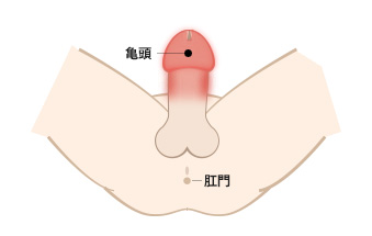 写真 カンジダ 症状 写真でみる腟カンジダ症の具体的な症状