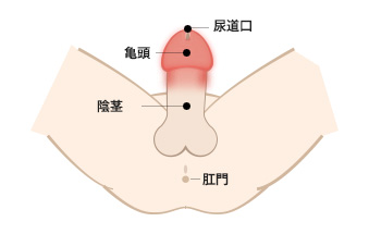 軟性下疳の説明 Gme医学検査研究所 軟性下疳の説明 Gme医学検査研究所