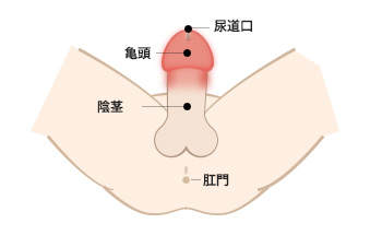 軟性下疳の説明 Gme医学検査研究所