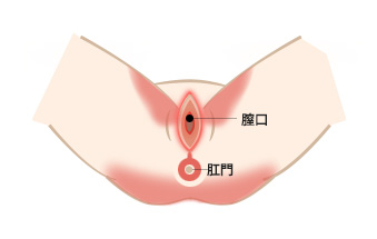 精 器 ヘルペス 男性 早く 治す