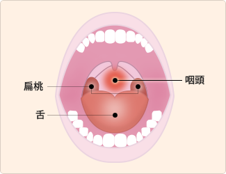 キス 性病