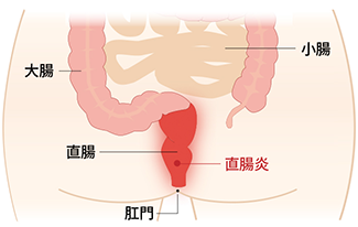 症状と潜伏期間について